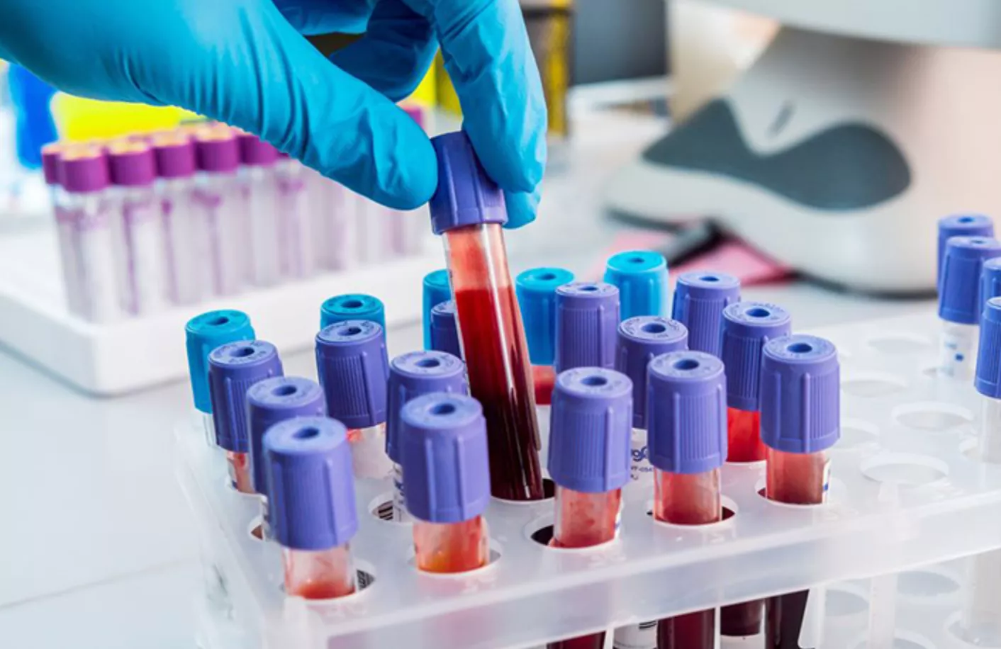 A PARTIR DE HOY BIOQUÍMICOS COBRAN UNA DIFERENCIA EN SUS ARANCELES