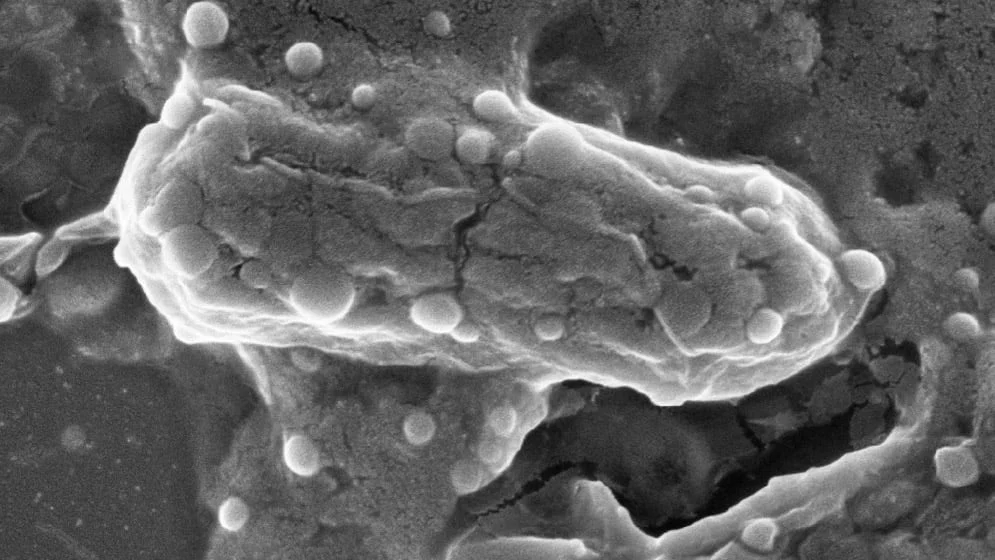 Científicos argentinos hallan un arma poderosa contra las "superbacterias": el cannabis potencia un antibiótico clave