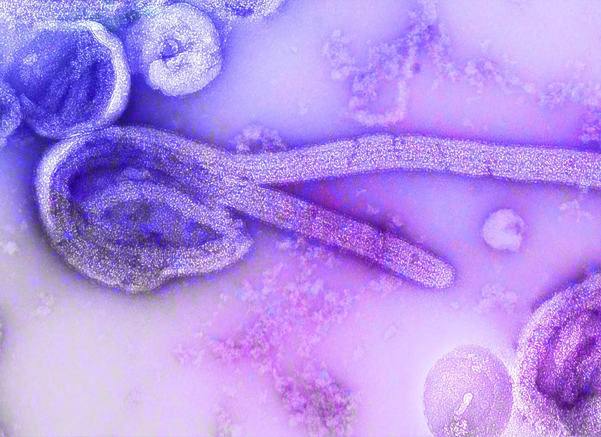 ALERTA: 78 FALLECIDOS POR STREPTOCOCCUS EN ARGENTINA