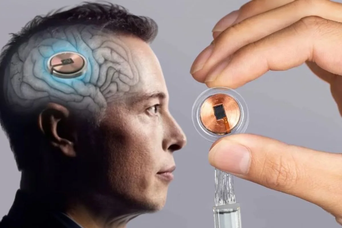 Interfaz cerebro-computadora: Neuralink avanza hacia la producción masiva